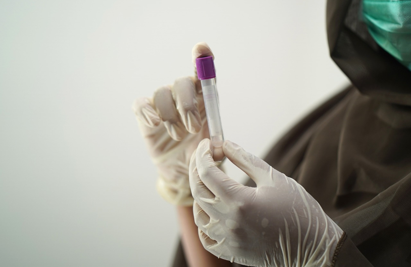 Image of blood tests